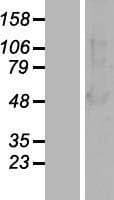 Human ARRB1 / Beta Arrestin 1 Protein (Over-Expression Lysate Myc-DDK (Flag))