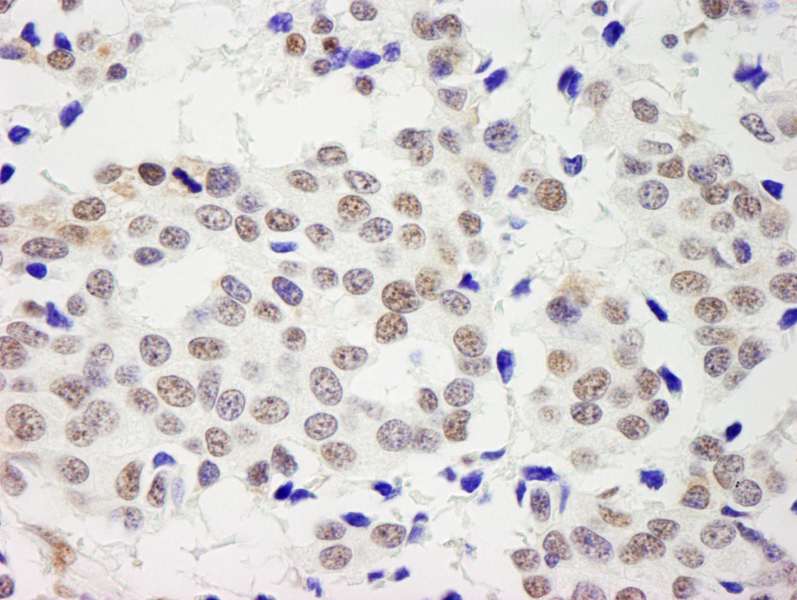 RECQ1 / RECQL Antibody (aa600-C-term)