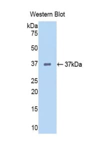 KDR / VEGFR2 / FLK1 Antibody (aa46-320, Cy3)