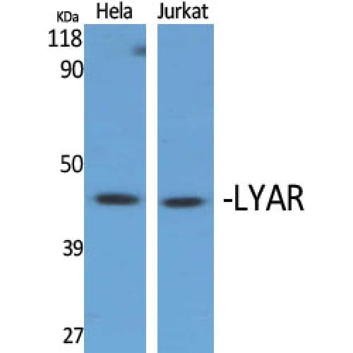 Polyclonal Rabbit anti-Human LYAR Antibody (210-290 aa, Internal, IHC, WB)