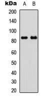 GYS1 / Glycogen Synthase Antibody (C-Terminus)