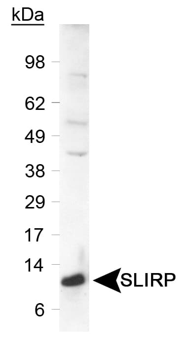 SLIRP / C14orf156 Antibody (C-Terminus)