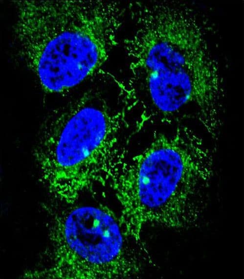 Polyclonal Rabbit anti-Human ADH7 Antibody (aa318-346, IHC, IF, WB)