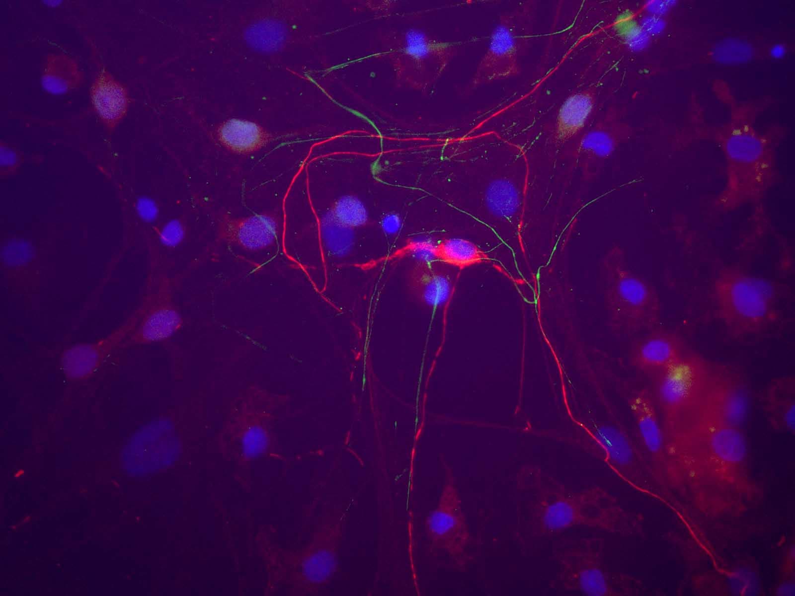 Peripherin Antibody (clone 8G2)