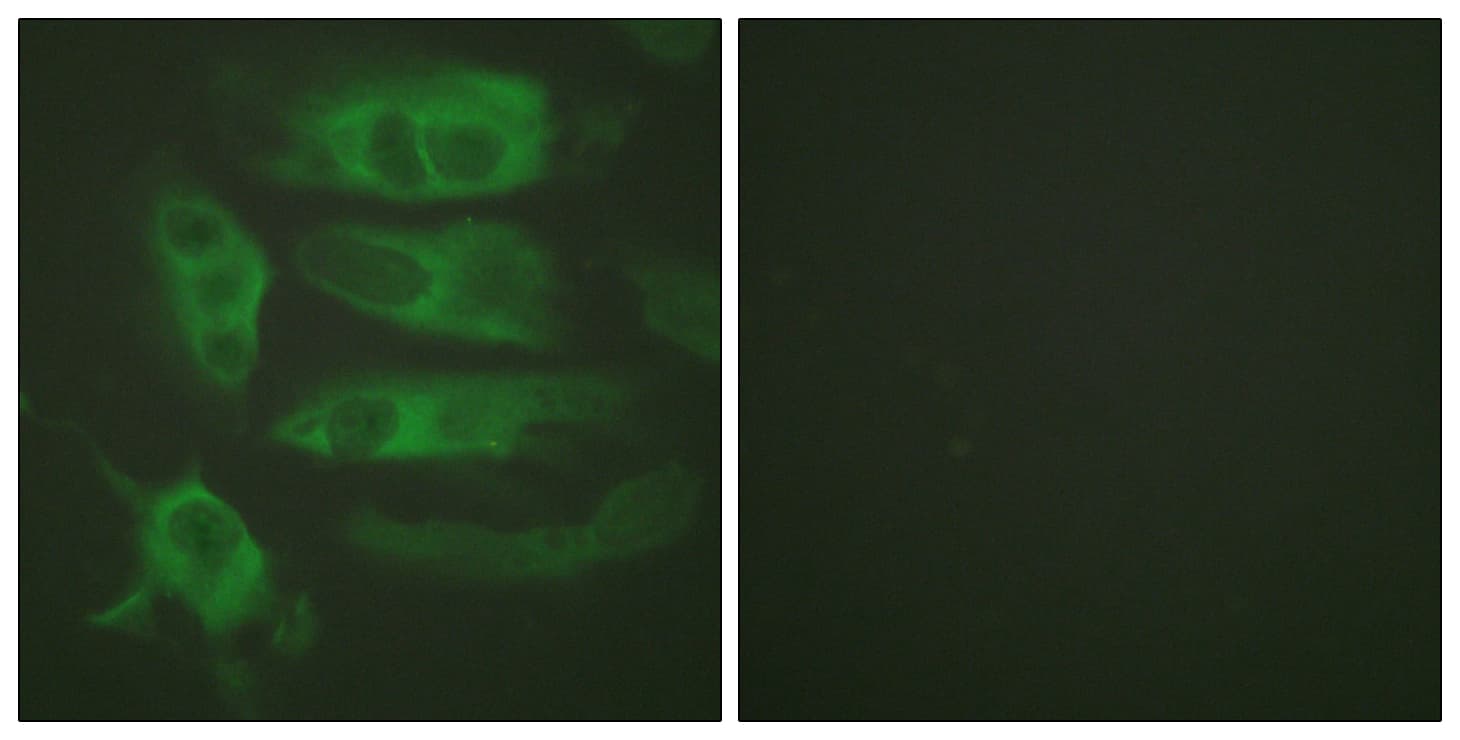 ADRB2 Antibody (aa321-370)