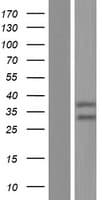STRADA / LYK5 Protein (Over-Expression Lysate Myc-DDK (Flag))