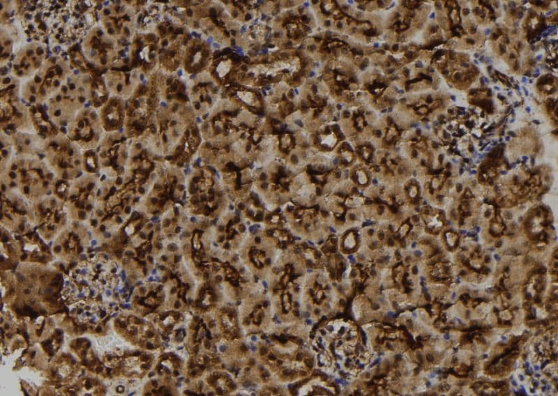 MGRN1 Antibody