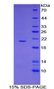Mouse ADAMTS2 Protein (Recombinant His)
