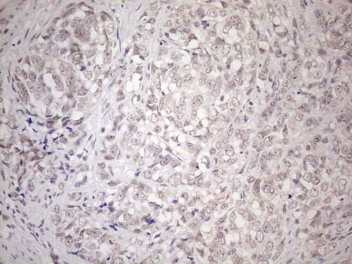 HSF2 Antibody (aa74-324, clone OTI3E1)