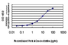 PEPD / PROLIDASE Antibody (clone 1D5-H3)