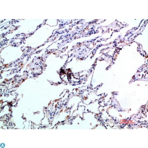 CCL24 / Eotaxin 2 Antibody