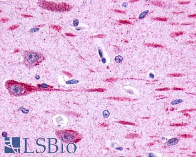 PathPlus™ GPR162 Antibody (Extracellular Domain)