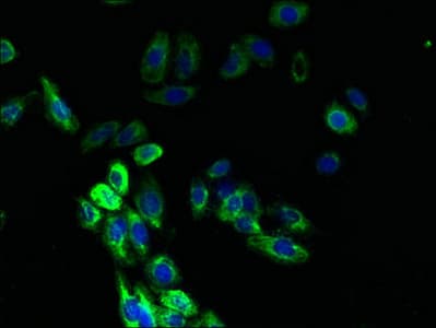 ACKR1 / DARC Antibody (aa1-63)