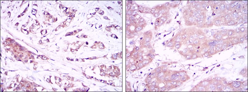 Monoclonal Mouse anti-Human BECN1 / Beclin-1 Antibody (clone 2A4, IHC, WB)