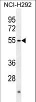 ACTL7A Antibody (aa41-67)