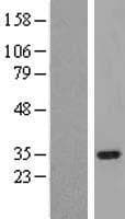SIMPL / IRAK1BP1 Protein (Over-Expression Lysate Myc-DDK (Flag))