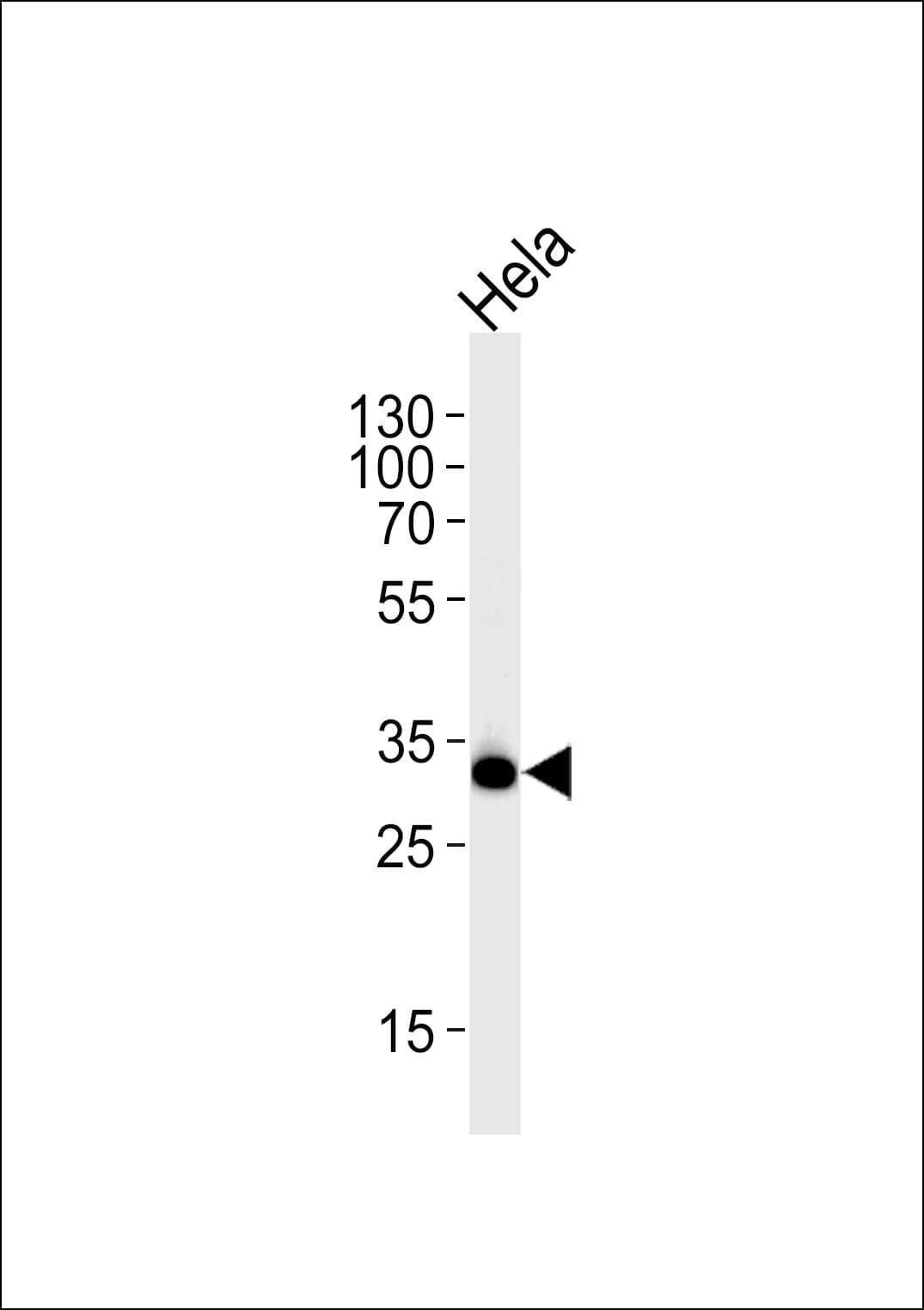 RPS6 / Ribosomal Protein S6 Antibody (Ser240/244)