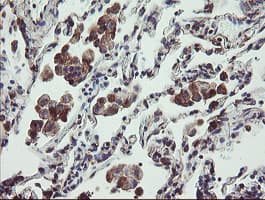 TPD52L3 Antibody (clone OTI8C12)