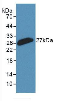 CLU / Clusterin Antibody (aa226-447)