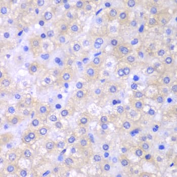 IHC-plus™ SH2D1A / SAP Antibody