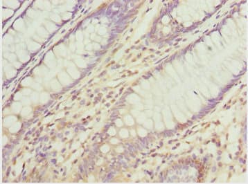 Polyclonal Rabbit anti-Human ATOH7 / MATH5 Antibody (IHC)