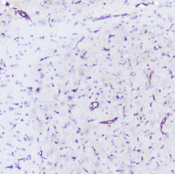 INPPL1 / SHIP2 Antibody