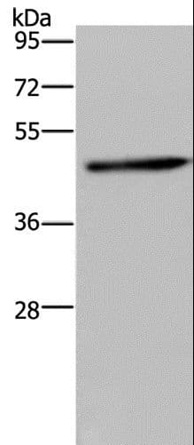 Polyclonal Rabbit anti-Human HOMER1 / Homer 1 Antibody (IHC, WB)