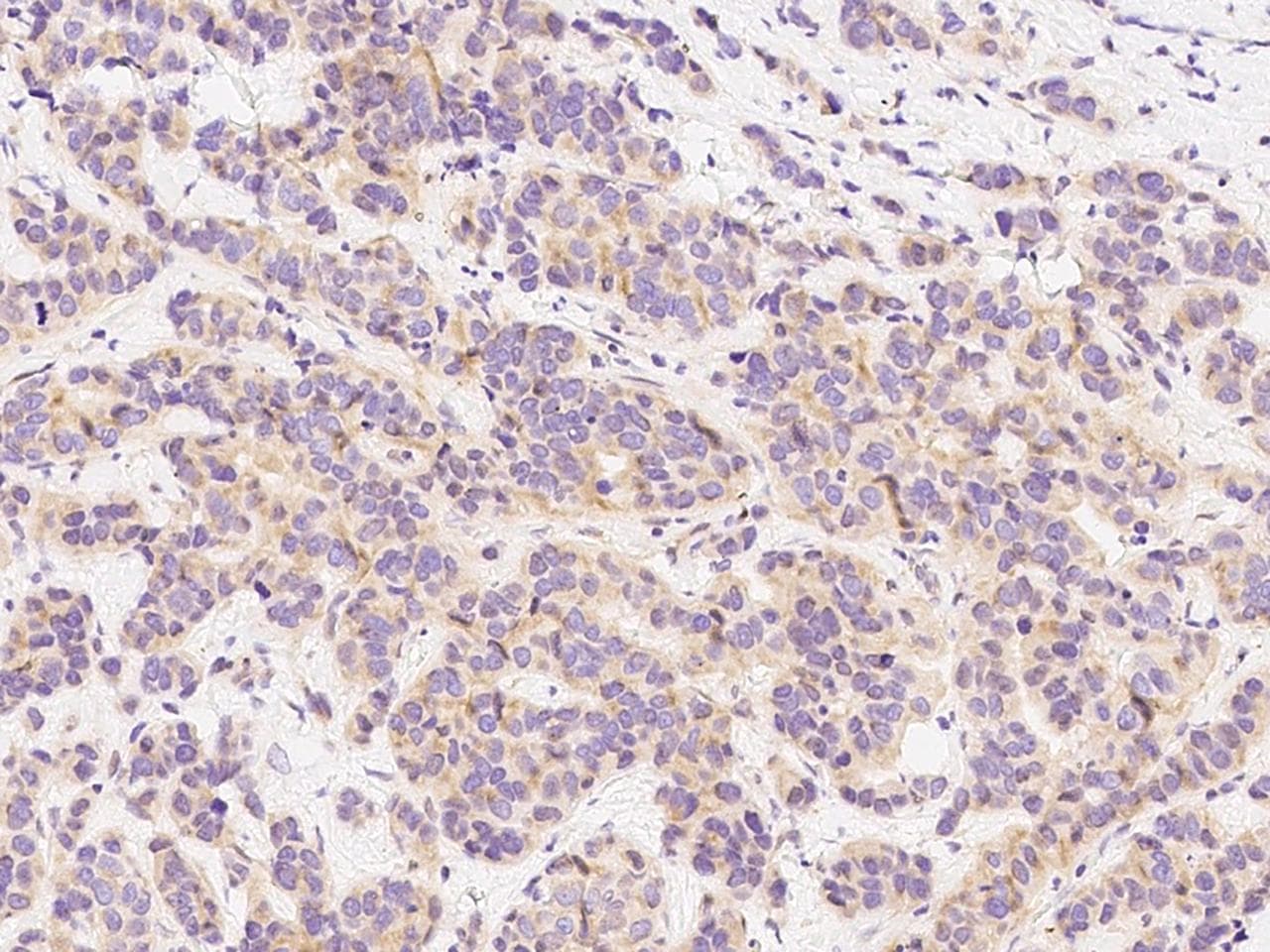 Polyclonal Rabbit anti-Human PRLR / Prolactin Receptor Antibody (Preservative Free, IHC)