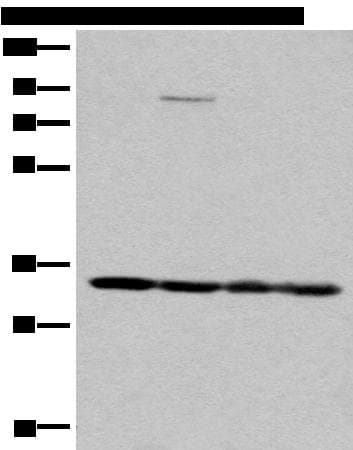 Polyclonal Rabbit anti-Human BM022 / MRPL1 Antibody (IHC, WB)