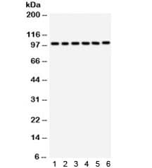 Polyclonal Rabbit anti-Human GOK / STIM1 Antibody (IHC, WB)