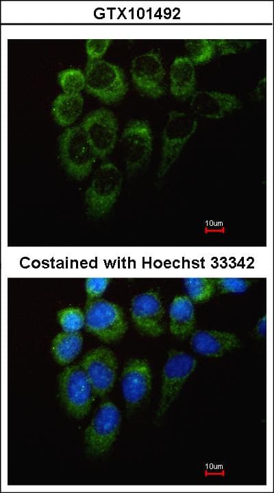 YARS / Tyrosyl-tRNA Synthetase Antibody