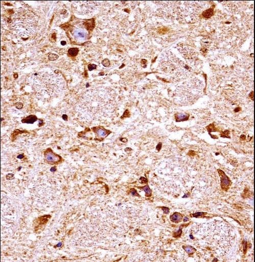 FGFR3 Antibody (aa468-495)