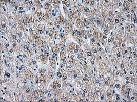 Monoclonal Mouse anti-Human AKR1A1 Antibody (clone OTI4G2, IHC, WB)