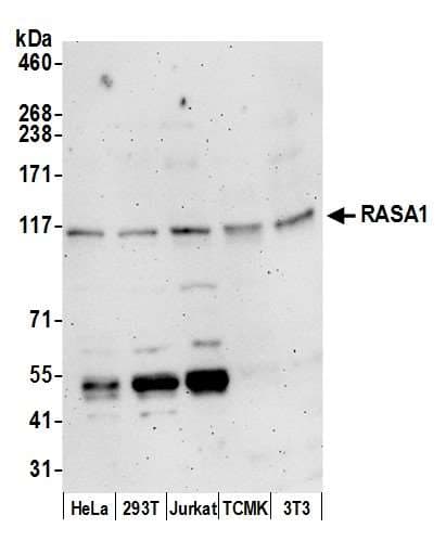 RASA1 Antibody (aa625-675)