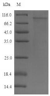 Mouse DSG2 / Desmoglein 2 Protein (Recombinant 6His-SUMO, N-terminus)