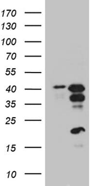 CREM / ICER Antibody (clone OTI7A2)