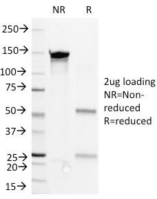 CD36 Antibody (clone 1E8)
