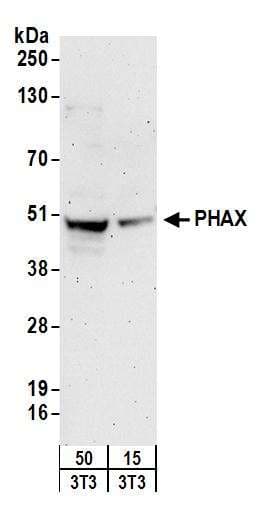 IHC-plus™ FBL / FIB / Fibrillarin Antibody (aa1-50)