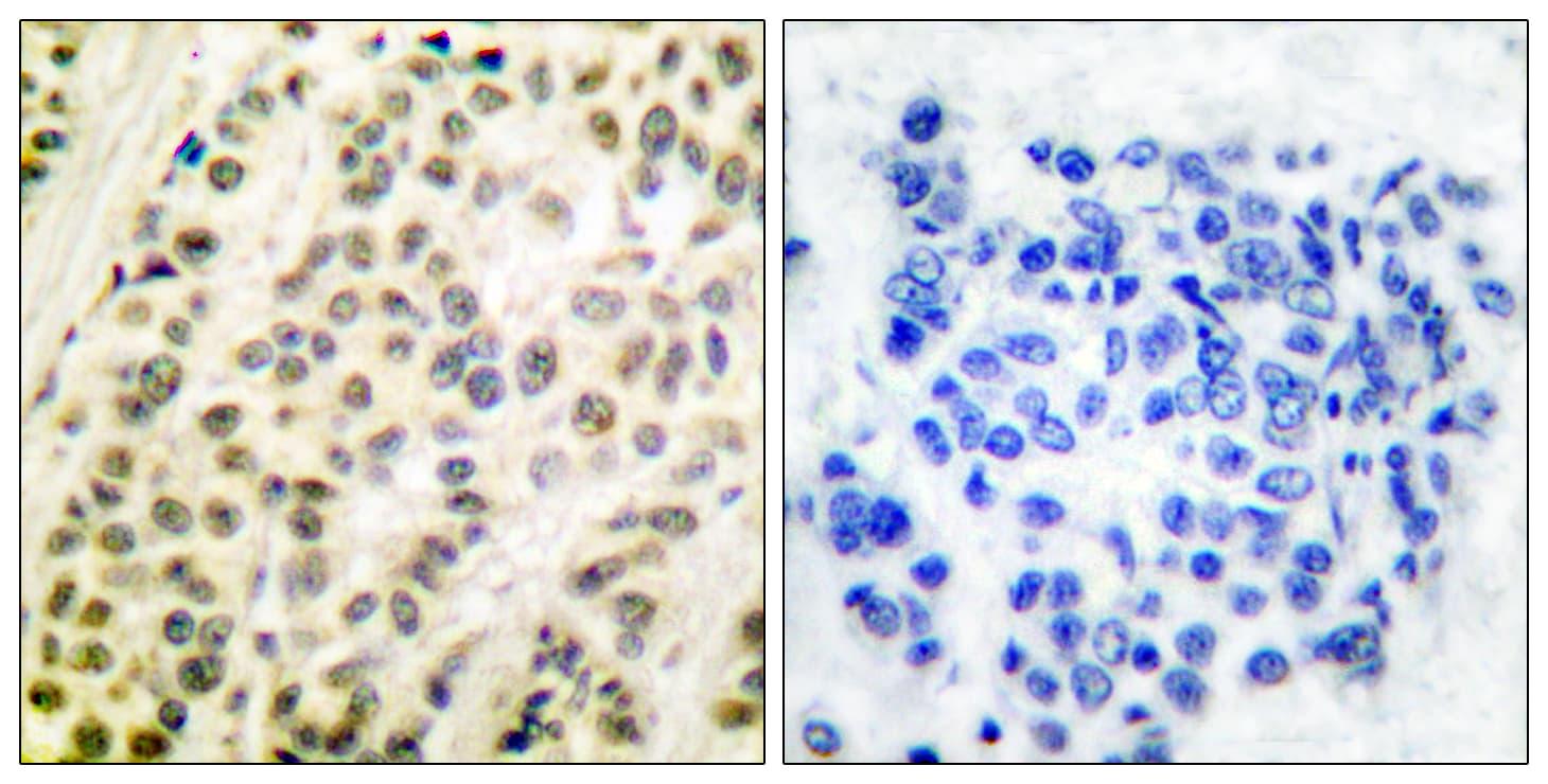 Polyclonal Rabbit anti-Human TFDP1 Antibody (aa361-410, IHC, IF, WB)