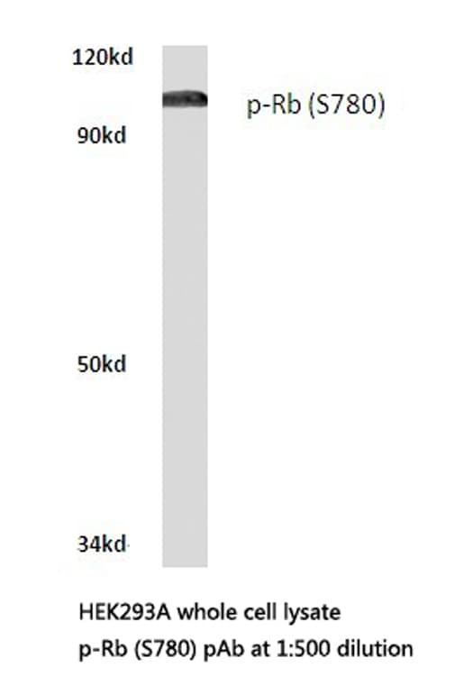 RB1 / Retinoblastoma / RB Antibody (phospho-Ser780)
