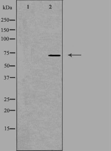 SLC6A8 Antibody