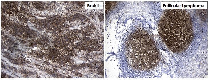 MME / CD10 Antibody (aa411-750, clone UMAB235, Carrier-free)