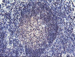 RFXANK Antibody (clone OTI2G7)