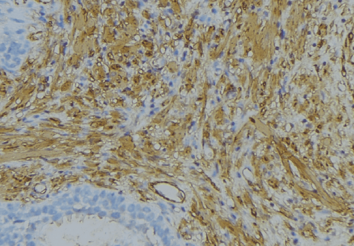 COL6A2 / Collagen VI Alpha 2 Antibody