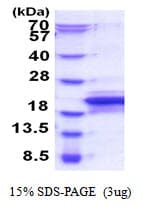 Human MOSPD1 Protein (Recombinant His)