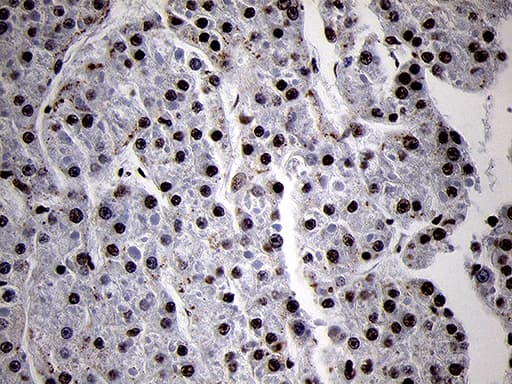 Monoclonal Mouse anti-Human SMC1A / SMC1 Antibody (clone OTI3G4, aa889-1016, IHC, WB)