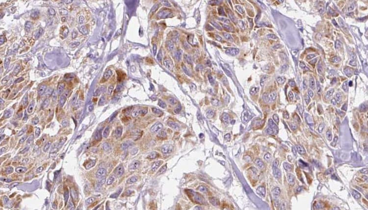 CXCL10 / IP-10 Antibody