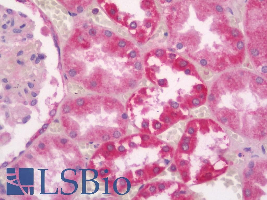 IHC-plus™ Polyclonal Goat anti-Human CDH1 / E Cadherin Antibody (IHC, WB)