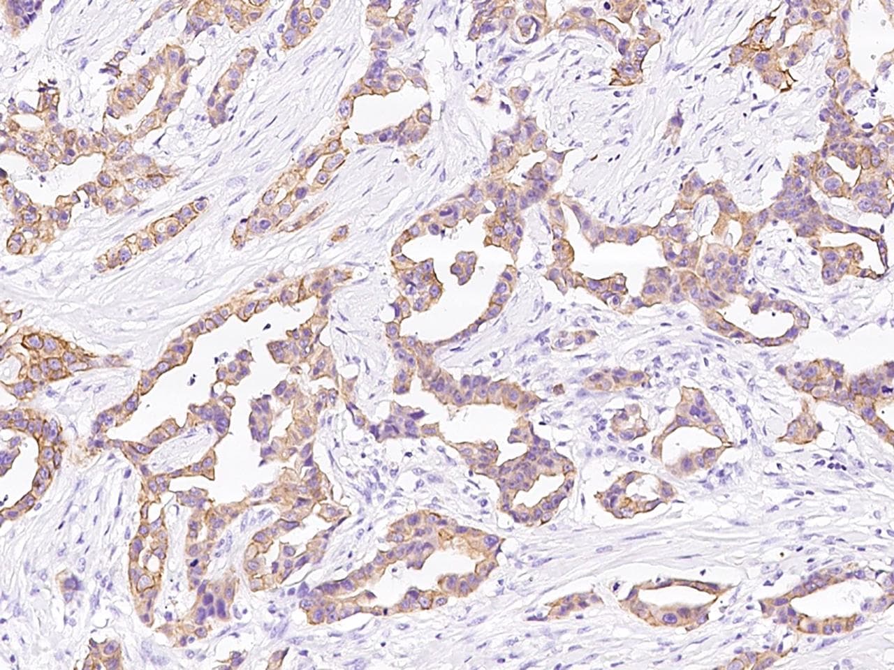 KRT6C / CK6C / Cytokeratin 6C Antibody