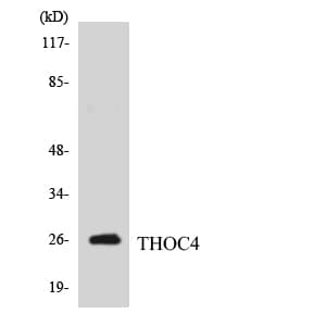 Polyclonal Rabbit anti-Human ALY / THOC4 Antibody (aa112-161, WB)